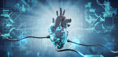 Artificial,Heart,Bionic,(3d,Rendering)